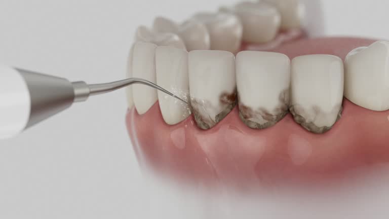 Trusted Teeth Cleaning And Checkup service in Little River-Academy, TX - Dentist Open Now
